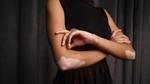 A photo from Vaseline’s See My Skin campaign